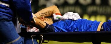 'Pecoso' Correa sufre trauma craneal en Cali vs. Once Caldas