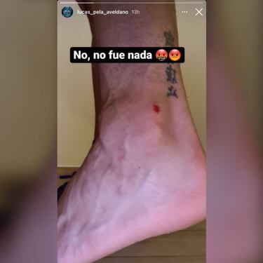 Lucas Aveldaño, molesto, exhibe cómo quedó su tobillo tras el pisotón de Julio Barroso