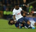 André Gomes se parte el tobillo y Pochettino se queja de la roja