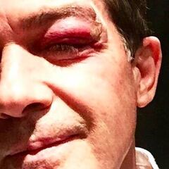 Antonio Banderas sufre un percance en el rodaje de ‘Stoic’