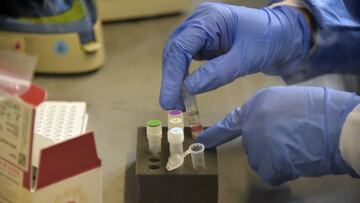 A medical worker tests samples of suspected Covid-19 cases at the laboratory of the IESS Carlos Andrade Marin hospital in Quito, on June 17, 2020. - Ecuador, one of the Latin American countries hardest hit by the pandemic, has surpassed 4,000 deaths since it declared the presence of the coronavirus in its territory on February 29, the government said Wednesday. (Photo by RODRIGO BUENDIA / AFP)