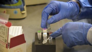 A medical worker tests samples of suspected Covid-19 cases at the laboratory of the IESS Carlos Andrade Marin hospital in Quito, on June 17, 2020. - Ecuador, one of the Latin American countries hardest hit by the pandemic, has surpassed 4,000 deaths since