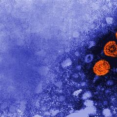 Hepatitis infantil aguda: CDMX detecta cuatro casos sospechosos