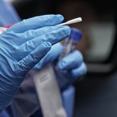 Pruebas gratis del COVID hoy, 5 de abril en Bogotá: lugares dónde hacértela gratis