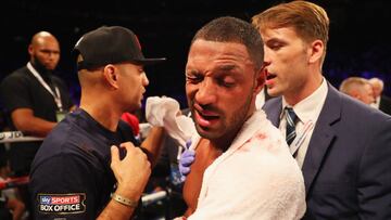 Brook sufre una fractura en el hueso orbital y será intervenido