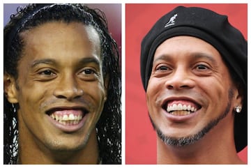El brasileño es uno de los futbolistas que más ha sonreído dentro del terreno de juego, por lo que llamó mucho la atención cuando después de su retirada decidió pasar por el dentista para lucir una nueva y mejorada sonrisa.