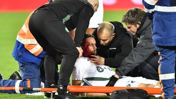 Subotic, atendido por los médicos tras recibir un escalofriante rodillazo en la cara.