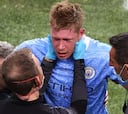 De Bruyne tiene una doble fractura en la cara