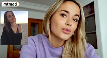 El antes y el después de Gal·la tras sus retoques estéticos