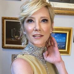 La actriz Anne Heche, en estado crítico tras chocar contra una casa