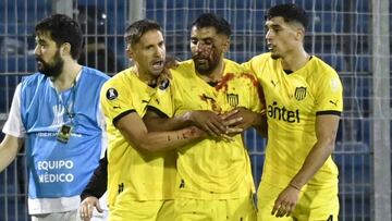 Maximiliano Olivera, con la cara ensangrentada tras recibir el impacto de una piedra.