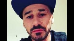 Mora desmiente en Instagram que sufra cáncer