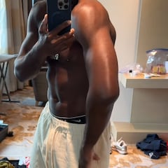 Así quedó el brazo de Sterling después del codazo a Ortega