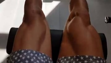 Valverde exhibe piernas para mostrar cómo va mejorando