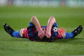 Fecha: 07-03-2016 | Partido: Barcelona - Chelsea | Lesión: Rotura del bíceps femoral de la pierna derecha.