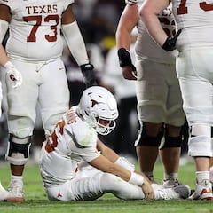 Surgery for Arch Manning, Longhorns confirm