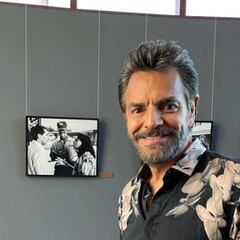 Eugenio Derbez sufre accidente: Qué le pasó y por qué fue intervenido quirúrgicamente