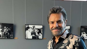 Eugenio Derbez sufre accidente: Qué le pasó y por qué fue intervenido quirúrgicamente