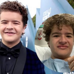El actor de Stranger Things, Gaten Matarazzo, anuncia su cuarto paso por el quirófano