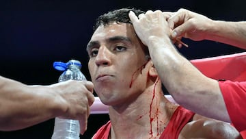 El boxeo español, indignado: “Ahora, un francés en Francia...”