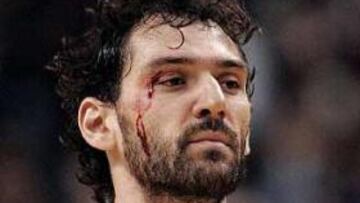 <b>SANGRE Y VICTORIA. </b>Jorge Garbajosa sangra de un corte en el ojo durante el partido frente a Philadelphia.