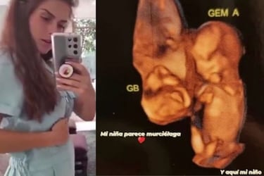 Claudia Álvarez presume su pancita de embarazo y comparte ultrasonido