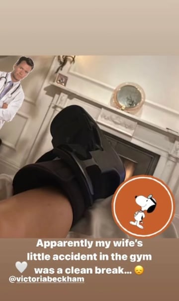 David Beckham muestra una imagen de la pierna de Victoria tras su accidente en el gimnasio.