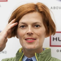 Bimba Bosé: "Tengo metástasis en huesos, hígado y cerebro"