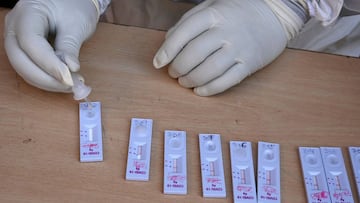 A health official checks nasal swab samples collected for shopkeepers and salesmen during a Rapid Antigen Test (RAT) for the Covid-19 coronavirus inside a private school in Srinagar on September 8, 2020. - India overtook Brazil on September 7 as the coun