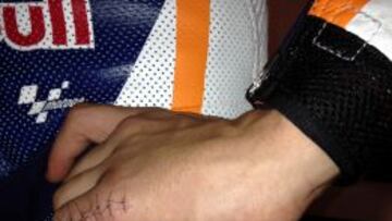 El doctor Mir “sorprendido” por el puesto de Marc Márquez