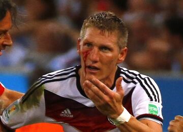 Bastian Schweinsteiger con la mejilla abierta tras un pu?etazo de Ag¨¹ero.