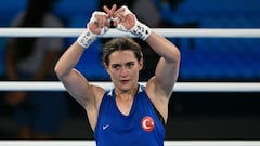 Turkish boxer Esra Yildiz protests after losing to Lin Yu-ting: what does the ‘X’ symbol mean?