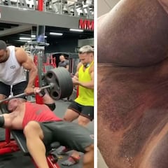 Sencillamente terrible: le revienta el pectoral al intentar levantar 220 kg