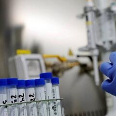 ¿Escapó el virus de un laboratorio? Hay un motivo clave