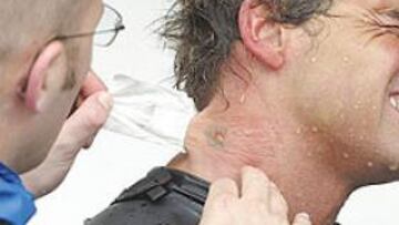 <b>CALVARIO</b>. El neopreno causa llagas. Pese a todo , ayer hubo quien se entrenó. El termómetro de nuestra embarcación marcó ayer 14,3 grados.