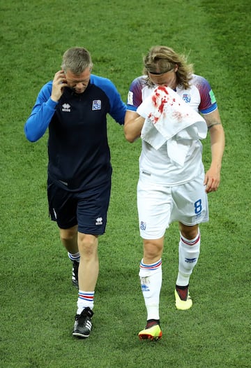 Birkir Bjarnason sale del campo lesionado.