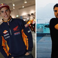 Márquez: "Compleja operación" para arreglar su hombro