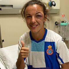 Sobresalto en el Espanyol-Eibar por un brusco choque de Lombi