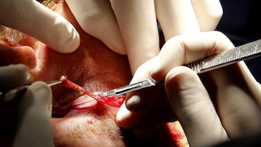 ¿Servirá como referencia para el futuro? Esta sentencia lo cambia todo en el sector de los cirujanos