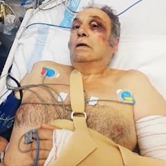 Tres turistas alemanes, policías de profesión, dan una paliza a un taxista de Mallorca