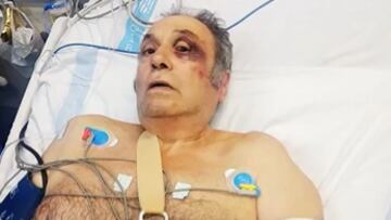 Tres turistas alemanes, policías de profesión, dan una paliza a un taxista de Mallorca