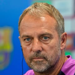 El doloroso dilema del Barcelona
