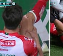 No apto para sensibles: la increíble lesión que vivió un jugador del Necaxa...