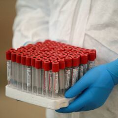 Atención Prioritaria por coronavirus en México: Resultado de la primera semana