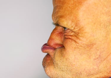 Los participantes se reúnen cada año para conseguir la expresión facial más grotesca posible.