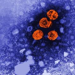 Hepatitis de origen desconocido en España: cuáles son sus síntomas