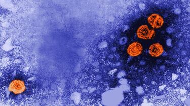 Así se contagia la hepatitis aguda: repuntan los casos en CDMX