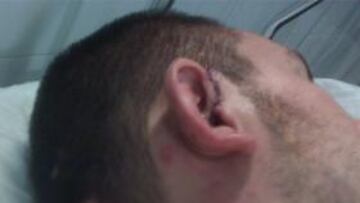 <b>FÚTBOL </b>Uno de los heridos atacados por los jugadores del Bada Bing.