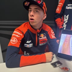 “El brazo me iba a explotar”