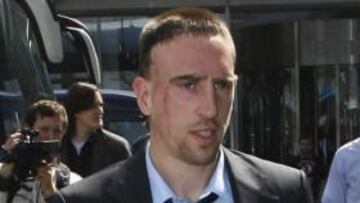 Ribéry.